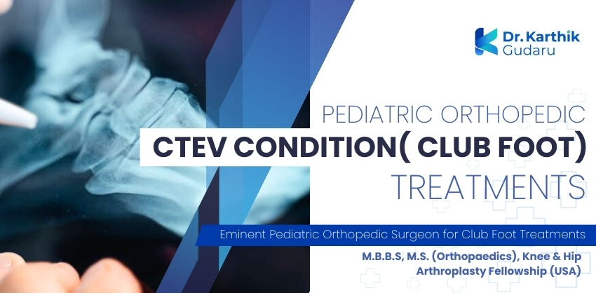 Best Orthopaedic doctor for CTEV Clubfoot treatment in Telangana Dr Karthik Gudaru